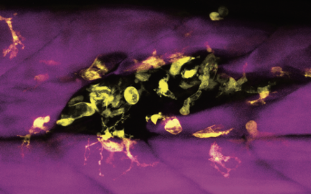 reversing-severe-muscle-wasting-in-disease-ageing-and-trauma-embl